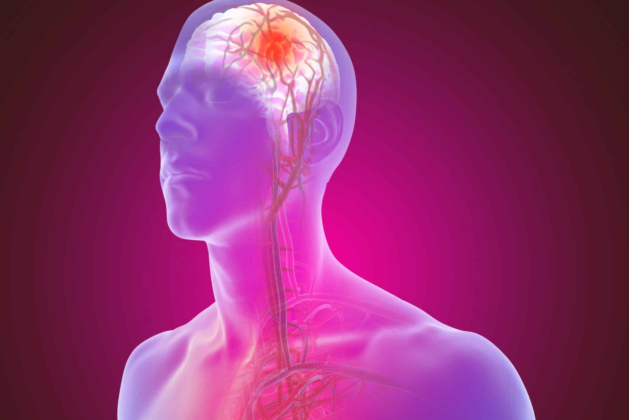A stroke represented via a graphical drawing